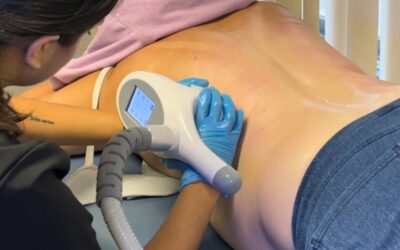Differences between CoolSculpting and Heat sculpting such as the Vela shape.
