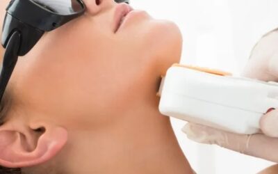 Potential Adverse Effects Associated with Laser Skin Treatments and How to Avoid Them